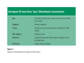 PR INTERVAL,CAUSES OF SHORT AND LONG PR INTERVAL | PPTX