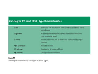 PR INTERVAL,CAUSES OF SHORT AND LONG PR INTERVAL | PPTX