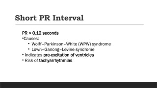 PR INTERVAL ECG. Pr interval ecg criteria | PPTX
