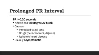 PR INTERVAL ECG. Pr interval ecg criteria | PPTX
