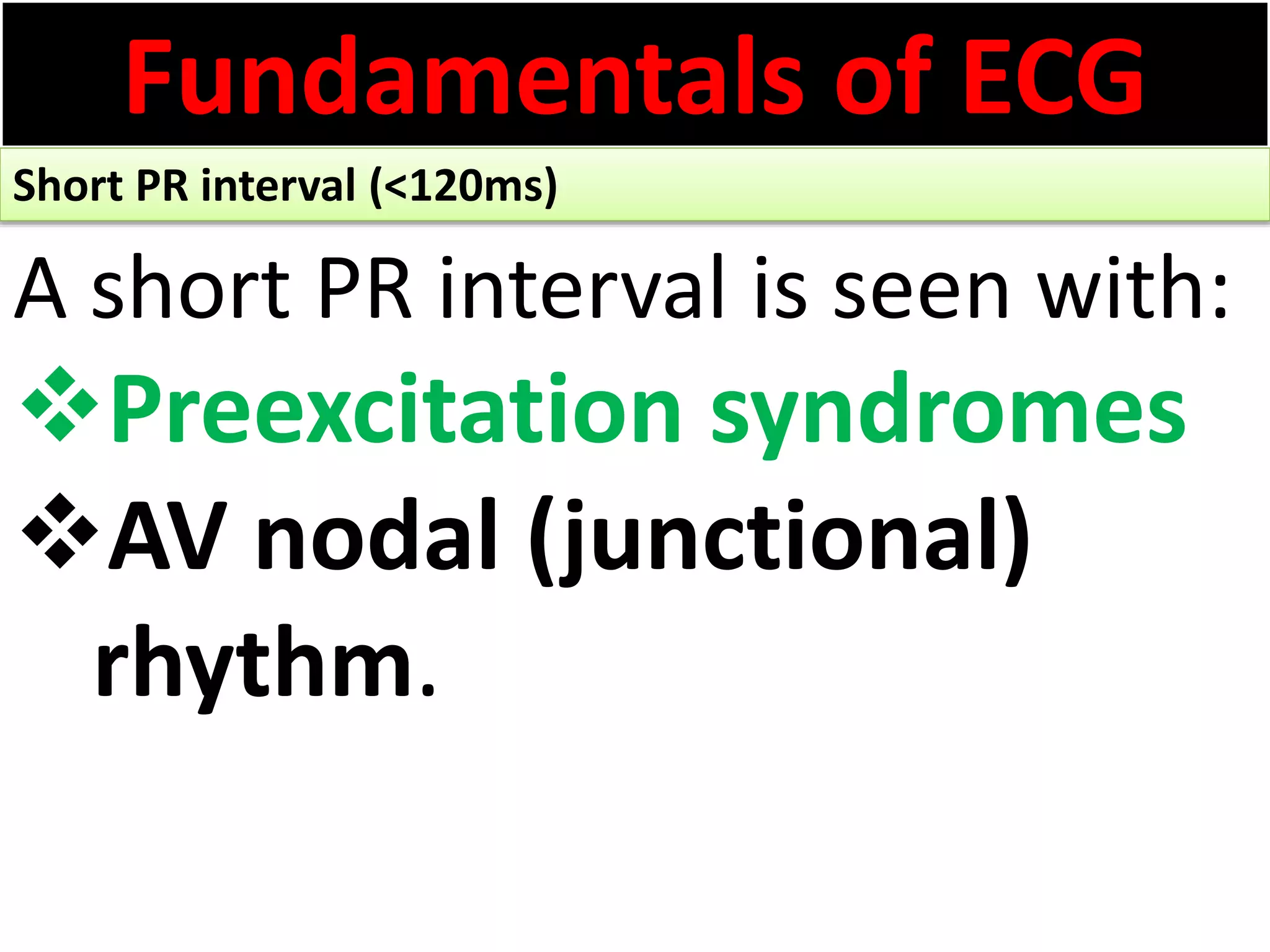 Fundamentals of ECG
Short PR interval (<120ms)
A short PR interval is seen with:
Preexcitation syndromes
AV nodal (junctional)
rhythm.
 