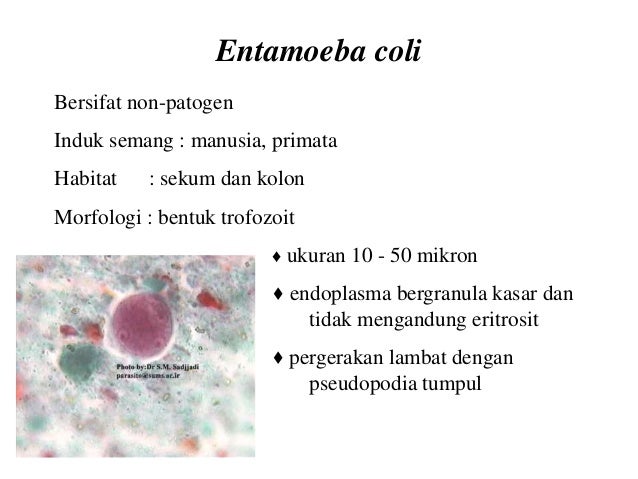 Protozoology Slideshare Protozoology Slideshare