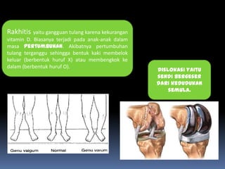 Kaki Rakhitis stuktur hewan- sistem rangka | PPTX