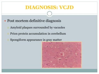 DIAGNOSIS: VCJD
 Post mortem definitive diagnosis
 Amyloid plaques surrounded by vacuoles
 Prion protein accumulation in cerebellum
 Spongiform appearance in gray matter
 