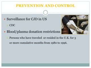 PREVENTION AND CONTROL
 Surveillance for CJD in US
 CDC
 Blood/plasma donation restrictions
 Persons who have traveled or resided in the U.K. for 3
or more cumulative months from 1980 to 1996.
 