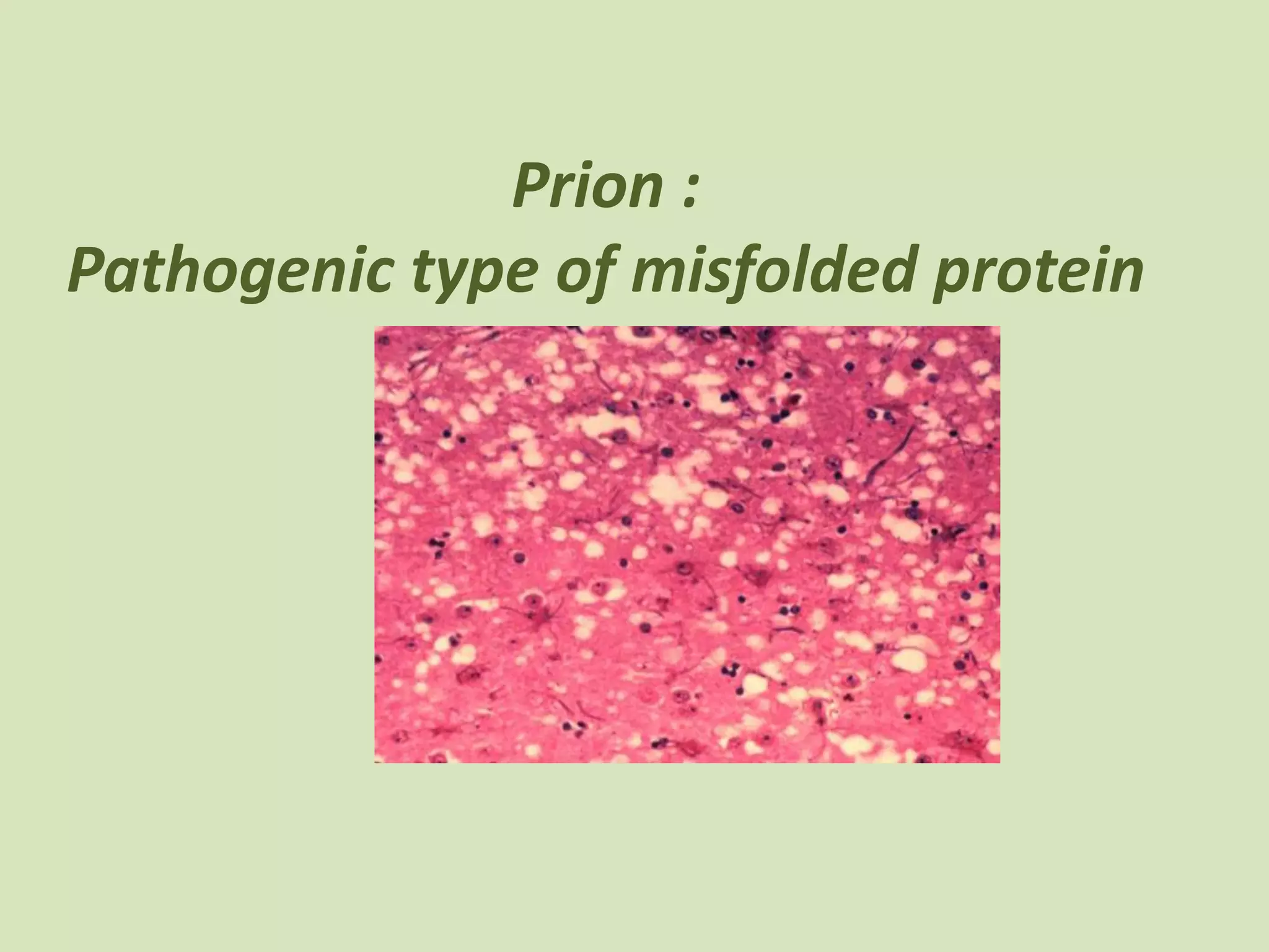 Prion :
Pathogenic type of misfolded protein