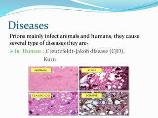 Diseases
Prions mainly infect animals and humans, they cause
several type of diseases they are-
In Human : Creutzfeldt-Jakob disease (CJD),
Kuru
 