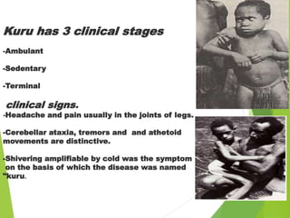 Kuru has 3 clinical stages
-Ambulant
-Sedentary
-Terminal
clinical signs.
-Headache and pain usually in the joints of legs.
-Cerebellar ataxia, tremors and and athetoid
movements are distinctive.
-Shivering amplifiable by cold was the symptom
on the basis of which the disease was named
"kuru.
 