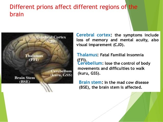 Prion disease