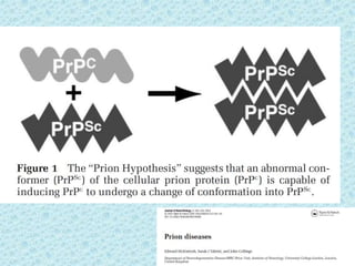 Prion diseases ---kuru | PPTX