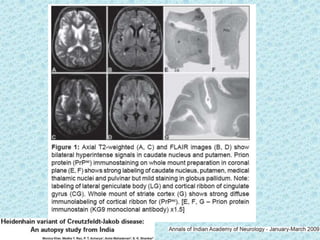 Prion diseases ---kuru | PPTX