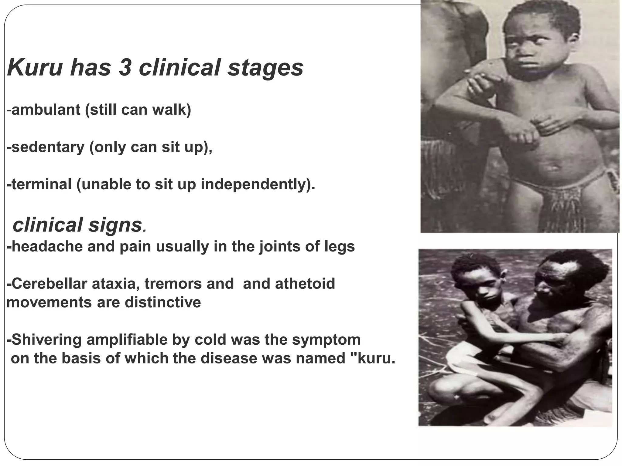 Prion diseases | PPTX