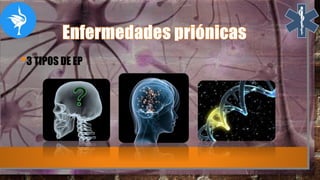 •3 TIPOS DE EP
 