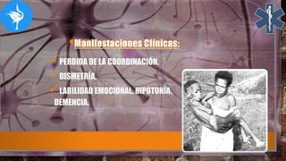 PERDIDA DE LA COORDINACIÓN.
DISMETRÍA,
LABILIDAD EMOCIONAL, HIPOTONÍA,
DEMENCIA.
 