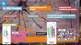 En 1982 Prusiner
Purifico el patógeno del
SCRAPIE
Compuesto en su
totalidad de una proteína
La Proteína Prion (PrP) Proteína normal Esta codificada por un gen que se encuentra
en muchos eucariontes.
La PrP normal (PrPC)
Scrapie (PrPSc)
 