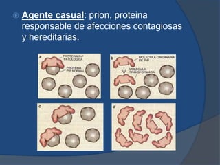  Agente casual: prion, proteina 
responsable de afecciones contagiosas 
y hereditarias. 
 