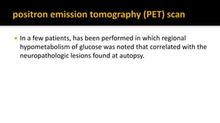  In a few patients, has been performed in which regional
hypometabolism of glucose was noted that correlated with the
neuropathologic lesions found at autopsy.
 
