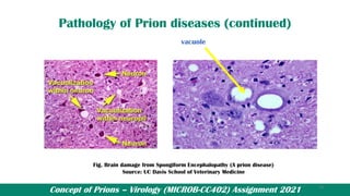 Concept of Prions – Virology (MICROB-CC402) Assignment 2021
Pathology of Prion diseases (continued)
vacuole
Fig. Brain damage from Spongiform Encephalopathy (A prion disease)
Source: UC Davis School of Veterinary Medicine
13
 