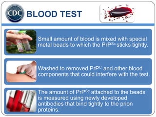 BLOOD TEST
Small amount of blood is mixed with special
metal beads to which the PrPSc sticks tightly.

Washed to removed PrPC and other blood
components that could interfere with the test.
The amount of PrPSc attached to the beads
is measured using newly developed
antibodies that bind tightly to the prion
proteins.

 