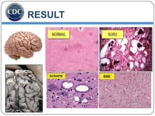 RESULT

SCRAPIE

BSE

 