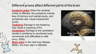 Presentation on prions diseases and its prevention | PPTX