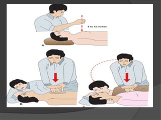 Priority Steps in Managing a Collapsed Person: Emergency Response and ...