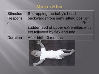 Moro reflex
Stimulus
Respons
e
S: dropping the baby’s head
backwards from semi sitting position.
R:
sudden abd of upper extremities with
ext followed by flex and add.
Duration After birth- 3 months
 