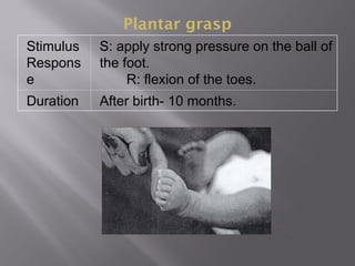 Plantar grasp
Stimulus
Respons
e
S: apply strong pressure on the ball of
the foot.
R: flexion of the toes.
Duration After birth- 10 months.
 