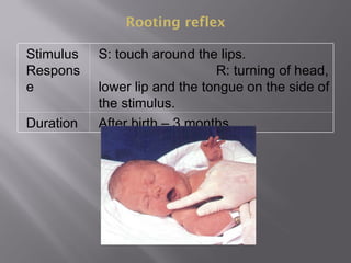 Rooting reflex
Stimulus
Respons
e
S: touch around the lips.
R: turning of head,
lower lip and the tongue on the side of
the stimulus.
Duration After birth – 3 months.
 
