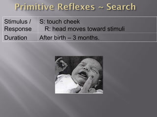 Stimulus /
Response
S: touch cheek
R: head moves toward stimuli
Duration After birth – 3 months.
 