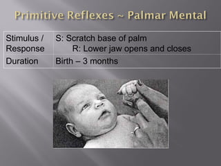 Stimulus /
Response
S: Scratch base of palm
R: Lower jaw opens and closes
Duration Birth – 3 months
 