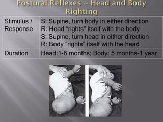 Stimulus /
Response
S: Supine, turn body in either direction
R: Head “rights” itself with the body
S: Supine, turn head in either direction
R: Body “rights” itself with the head
Duration Head:1-6 months; Body: 5 months-1 year
 