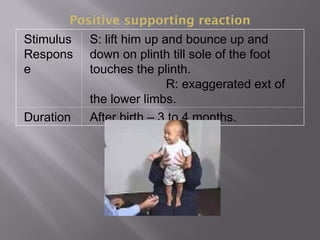 Positive supporting reaction
Stimulus
Respons
e
S: lift him up and bounce up and
down on plinth till sole of the foot
touches the plinth.
R: exaggerated ext of
the lower limbs.
Duration After birth – 3 to 4 months.
 