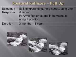 Stimulus /
Response
S: Sitting/standing, hold hands, tip in one
direction
R: Arms flex or extend in to maintain
upright position
Duration 3 months – 1 year
 