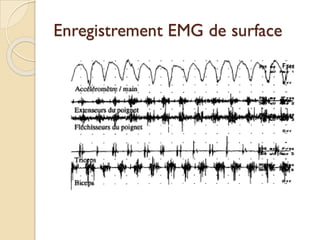 Enregistrement EMG de surface
 