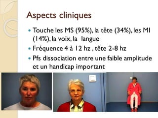 Aspects cliniques
 Touche les MS (95%),la tête (34%),les MI
(14%),la voix, la langue
 Fréquence 4 à 12 hz , tête 2-8 hz
 Pfs dissociation entre une faible amplitude
et un handicap important
 