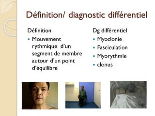 Définition/ diagnostic différentiel
Définition
 Mouvement
rythmique d’un
segment de membre
autour d’un point
d’équilibre
Dg différentiel
 Myoclonie
 Fasciculation
 Myorythmie
 clonus
 