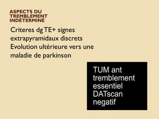 ASPECTS DU
TREMBLEMENT
INDÉTERMINÉ
Criteres dgTE+ signes
extrapyramidaux discrets
Evolution ultérieure vers une
maladie de parkinson
 