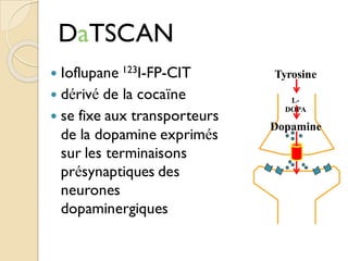 DaTSCAN
 Ioflupane 123I-FP-CIT
 dérivé de la cocaïne
 se fixe aux transporteurs
de la dopamine exprimés
sur les terminaisons
présynaptiques des
neurones
dopaminergiques
Tyrosine
L-
DOPA
Dopamine
 