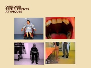 QUELQUES
TREMBLEMENTS
ATYPIQUES
 