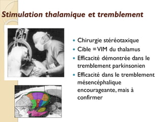 Stimulation thalamique et tremblement
 Chirurgie stéréotaxique
 Cible =VIM du thalamus
 Efficacité démontrée dans le
tremblement parkinsonien
 Efficacité dans le tremblement
mésencéphalique
encourageante, mais à
confirmer
 