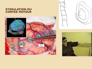 STIMULATION DU
CORTEX MOTEUR
 