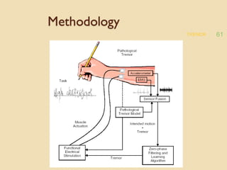 TREMOR 61
Methodology
 