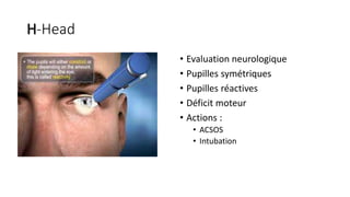 H-Head
• Evaluation neurologique
• Pupilles symétriques
• Pupilles réactives
• Déficit moteur
• Actions :
• ACSOS
• Intubation
 