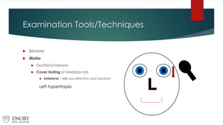 Examination Tools/Techniques
 Sensory
 Motor
 Ductions/Versions
 Cover testing or Maddox rod
 Unilateral – tells you direction and duration
Left hypertropia
 