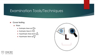Examination Tools/Techniques
 Cover testing
 Prism
 Esotropia: Base out
 Exotropia: Base in
 Hypertropia: Base down
 Hypotropia: Base up
 