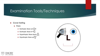 Examination Tools/Techniques
 Cover testing
 Prism
 Esotropia: Base out
 Exotropia: Base in
 Hypertropia: Base down
 Hypotropia: Base up
 