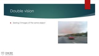 Double vision
 Seeing 2 images of the same object
 