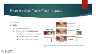 Examination Tools/Techniques
 Sensory
 Motor
 Ductions/Versions
 Cover testing or Maddox rod
 Subjective response from patient
 Exo and hyper’s are crossed
 Eso and hypo are uncrossed
Biousse V, Newman NJ Neuro-ophthalmology Illustrated 2nd ed New York : Thieme; 2016:349-
350
 