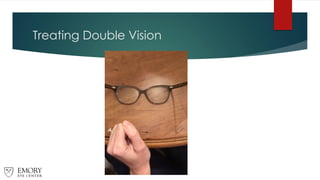 Treating Double Vision
 